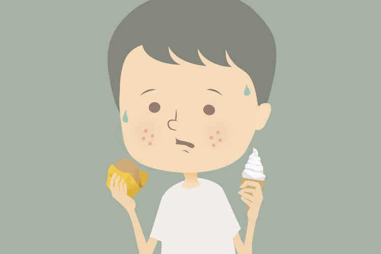 夏のニキビと食事の注意