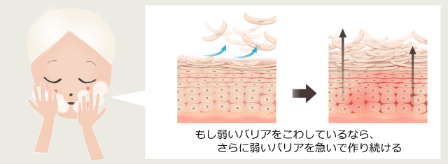 肌質を間違えるとピーリングでニキビは悪化する