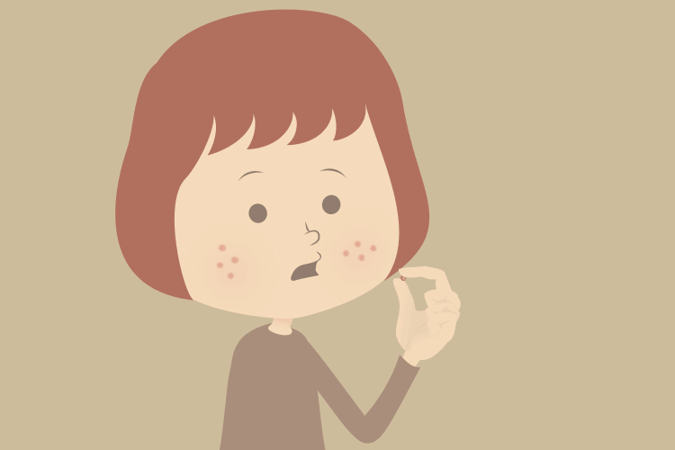 欧州、イソトレチノインの皮膚剥離についての警告追加