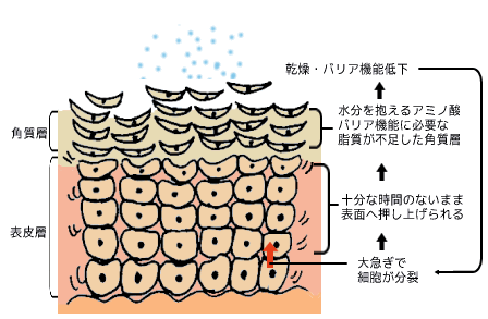 敏感肌では角質層の乾燥をくり返す。