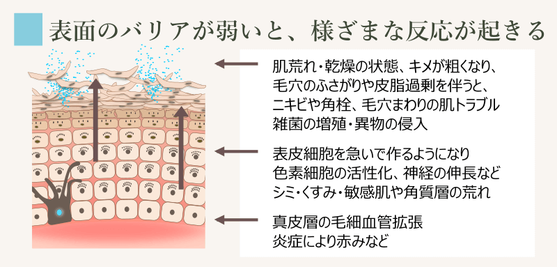 角質層の状態とニキビをはじめとする肌トラブル