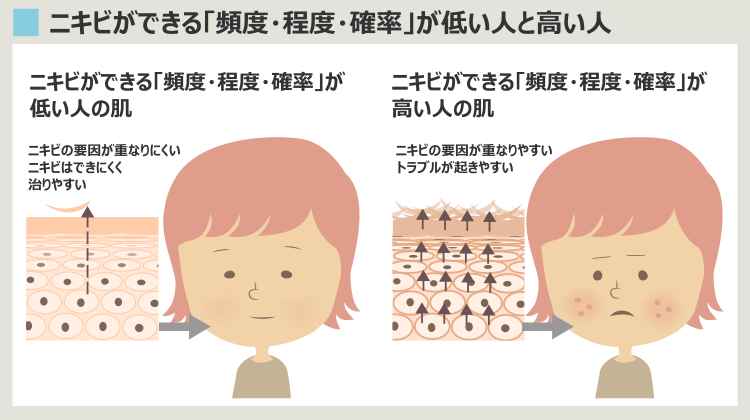 ニキビ治療は対症療法、重要なのはその人の肌質