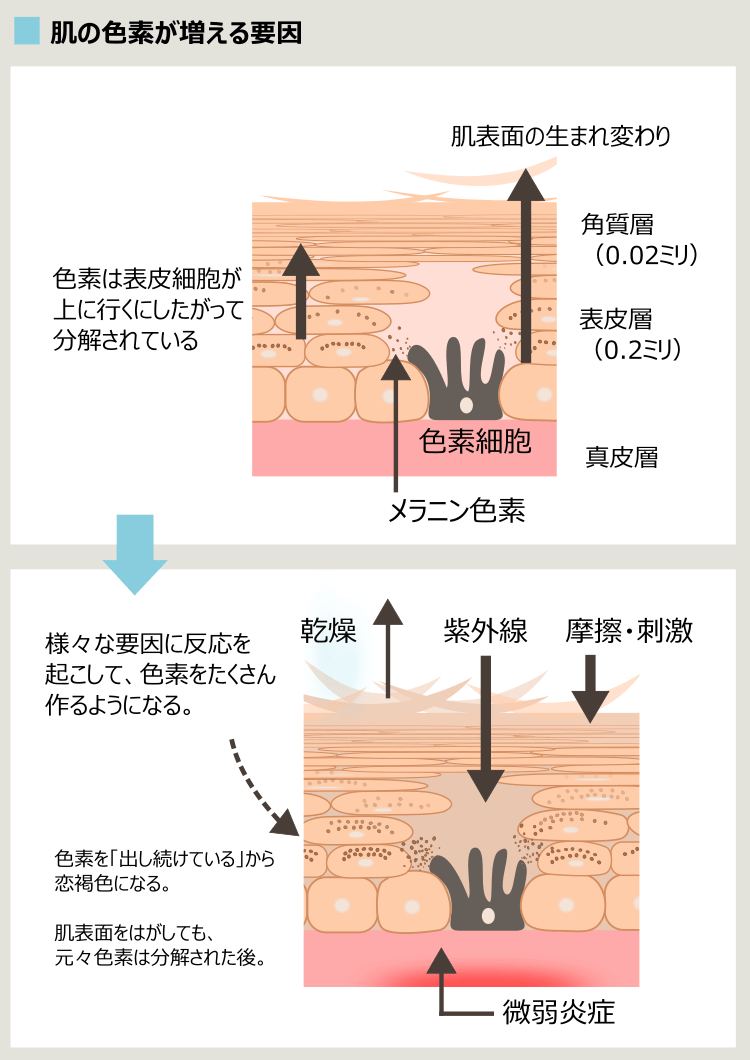 ニキビ痕と色素細胞