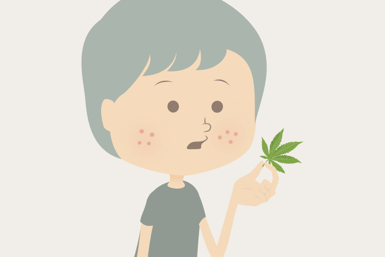 CBDのニキビ治療効果とは？