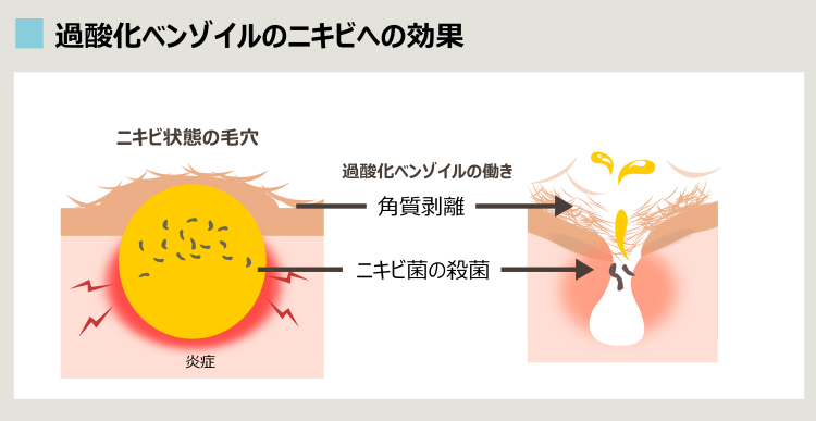 過酸化ベンゾイルの作用機序