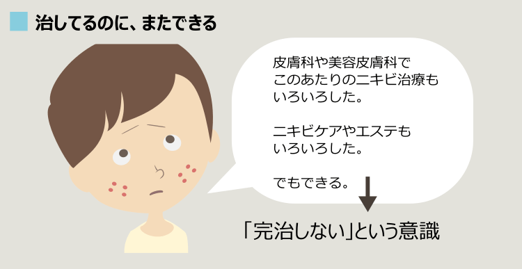 完治しないニキビ