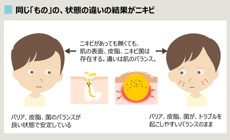 ニキビができる肌バランス