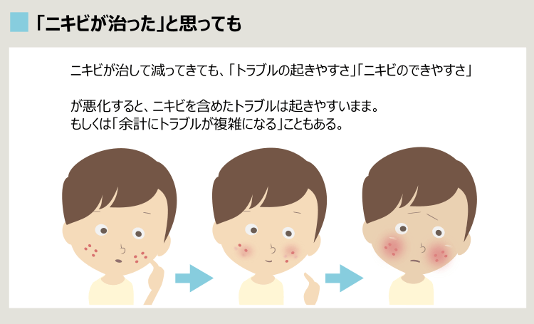 ニキビ治療で悪化